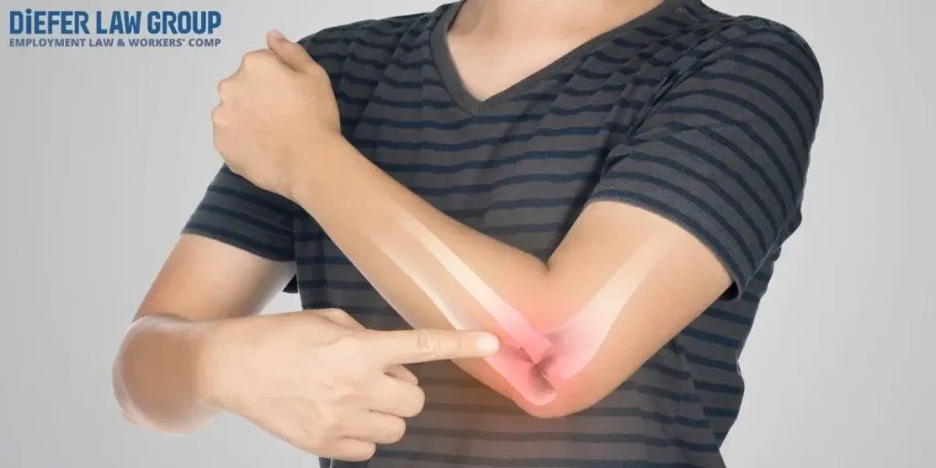 Trusted Los Angeles Hand and Finger Injury Lawyer​